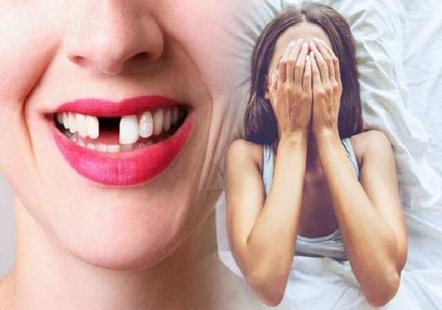 Mơ thấy gãy răng hàm trên là sao Mơ thấy gãy răng hàm trên là sao